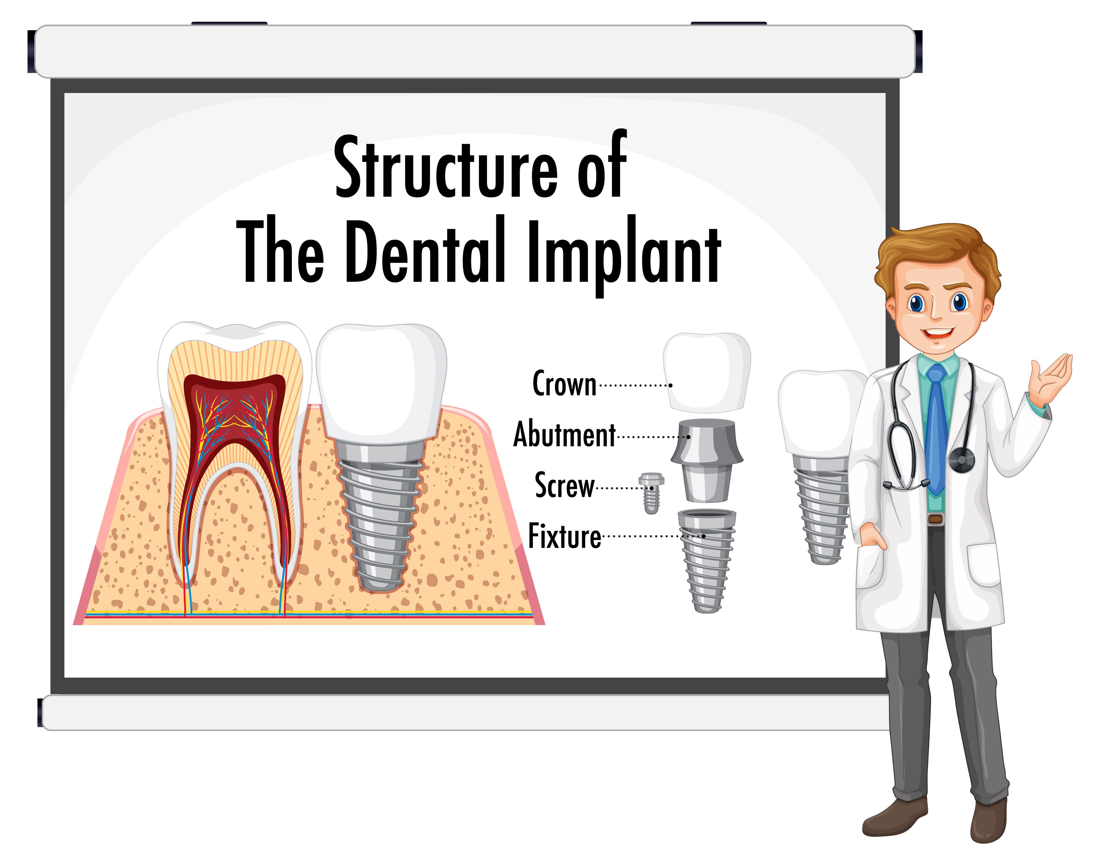 Are Dental Implants Worth It? Insights from Dr. Heeral Chikhal & Dr. Kalpesh Dey