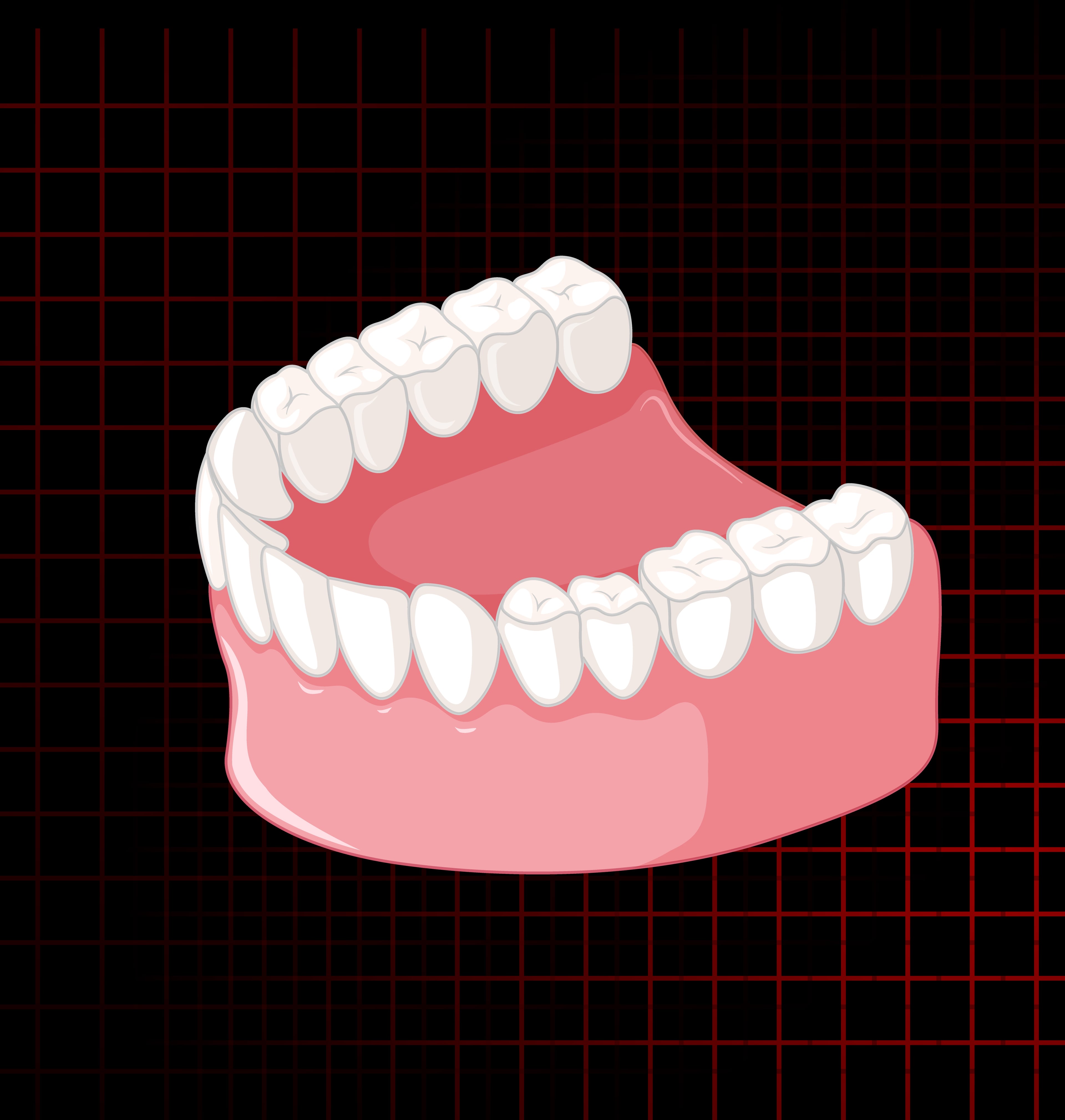 Full Mouth Reconstruction